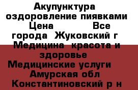 Акупунктура, оздоровление пиявками › Цена ­ 3 000 - Все города, Жуковский г. Медицина, красота и здоровье » Медицинские услуги   . Амурская обл.,Константиновский р-н